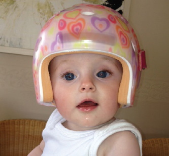 OTTOBOCK Redressiehelm voor baby