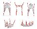REBOTEC Slings / Transportgordels assortiment voor tillift